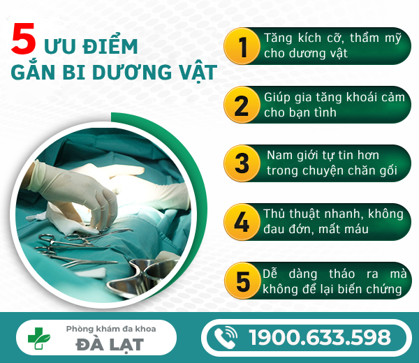 Hình ảnh minh họa